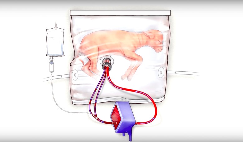 New Technology Could Let Women Terminate Pregnancy Without Killing the Baby