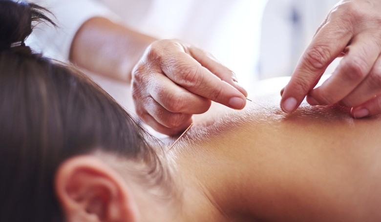 12-Year-Old Chinese Students Will Learn Acupuncture, Other Traditional Medicine Practices
