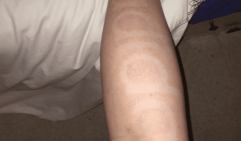 When You Wear Tight Pants to the Gym Too Soon After Self-Tanning