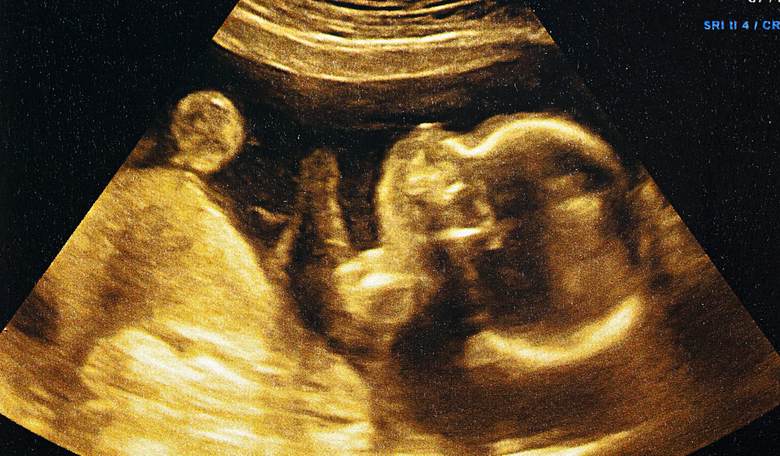 Unborn Victim of Church Shooting Recognized as Fully Human Under Texas Law