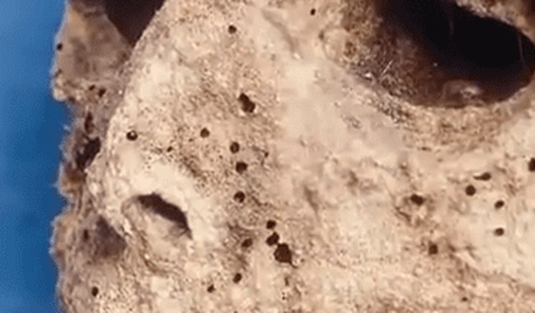 Oldest Known Case of Hepatitis B Discovered in 500-Year-Old Mummy Child