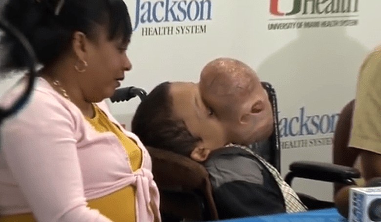 Teen with Basketball-Sized Tumor on Face Dies from Complications of Removal Surgery