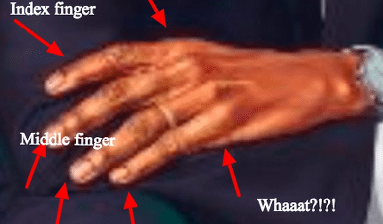 Did Artist Give Obama an Extra Finger to Go with His Freakishly Large Hands?