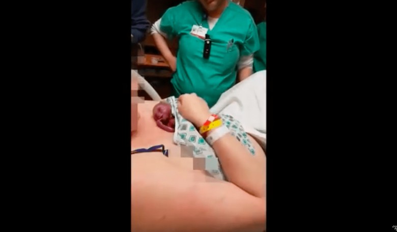 HEARTBREAKING VIDEO: 22-Week Preemie Twins Die in Mother’s Arms; Doctors Refuse to Help