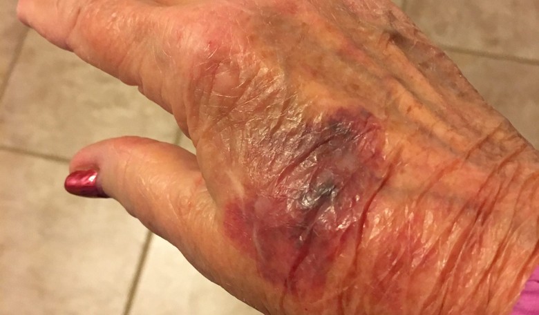 75-Year-Old GOP Volunteer in N.C. Says Dem Candidate Crushed Her Hand with Aggressive Handshake