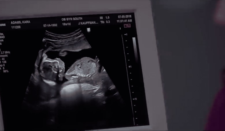 What’s in an Abortion? 'Disturbing' and 'Bloody,' According to the MPAA