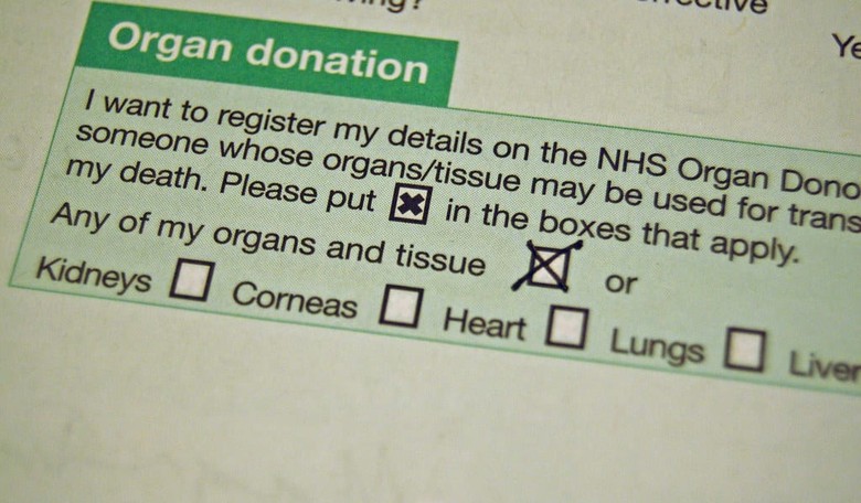 Why Should It Be Illegal to Sell an Organ?