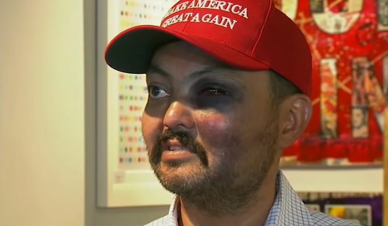 NY Man Who Was Beaten For Wearing a MAGA Hat Receives a Care Package from Trump