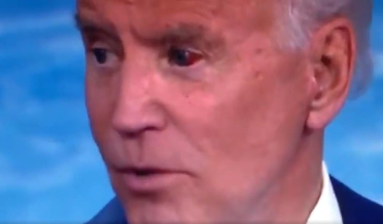 Is Joe Biden's Eye Okay?