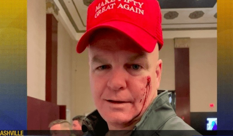 Man Sucker-Punched in the Face for Wearing MAGA-Style 'Make 50 Great Again' Hat