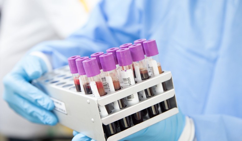 Communist Quality Control: Beijing Sends 150,000 Wuhan Virus Testing Kits to Prague, 80% Fail