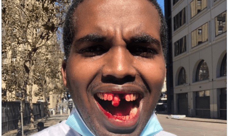 Antifa Attacks Pro-Trump Free Speech Protesters in San Francisco