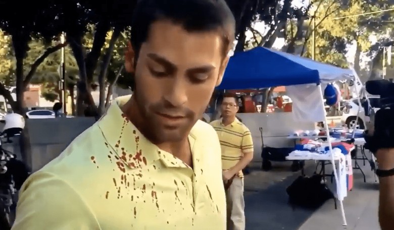 MAGA Nation Bleeds: Is Trump Ignoring Dangerous Political Violence Perpetrated Against His Own Supporters?