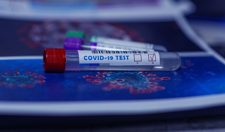 Is the Government Getting Your COVID Test Results Before You Do? Why?