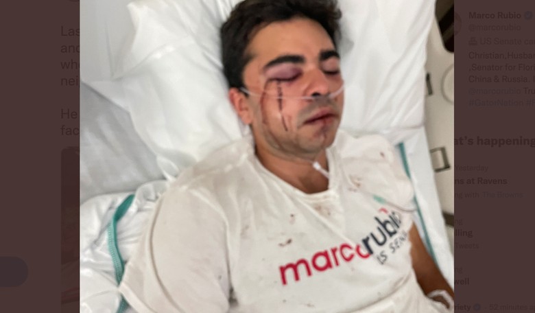 Your Kind Aren't Allowed Here: Thugs Beat the Crap Out of GOP Canvasser Wearing DeSantis, Rubio Gear