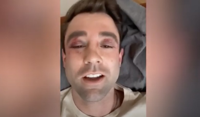 Heroic Fox News Meteorologist Defends Elderly Man From Pack of Vicious Teens, Is Severely Beaten