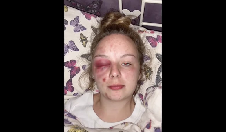 False Rape Accuser Gets 8 Years in Prison in the UK for Making Up Attack by 'Asian Rape Gang'