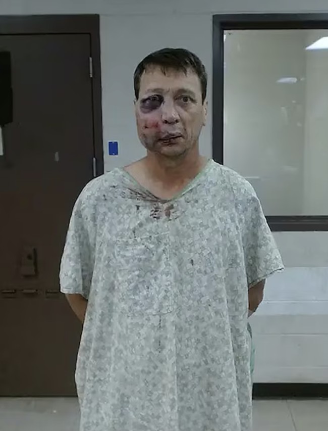 Brutal golf course fight produces one of the most gruesome mugshots.