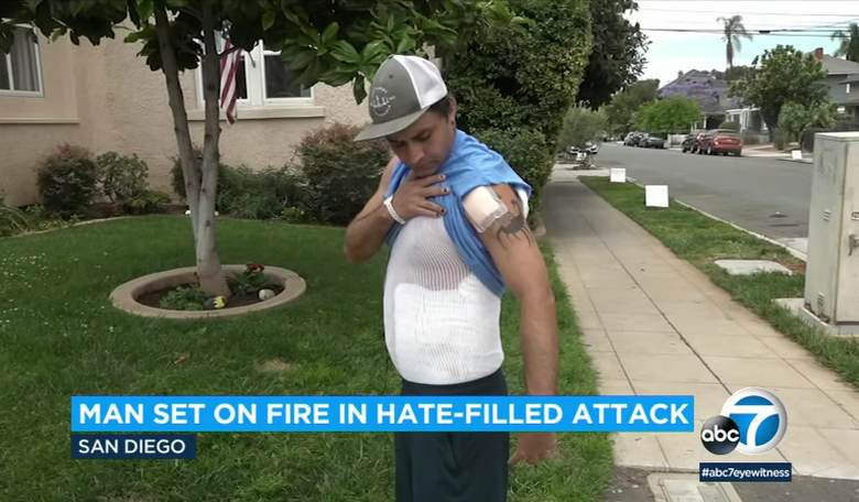 San Diego Man Claimed He Was Set On Fire Because He's Gay; CCTV Shows a Different Story