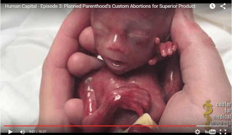 National Abortion Federation videos leaked