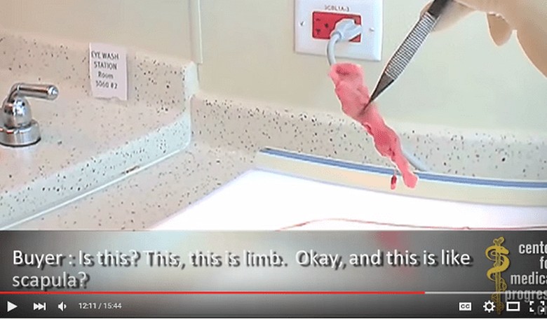 New Planned Parenthood video lands
