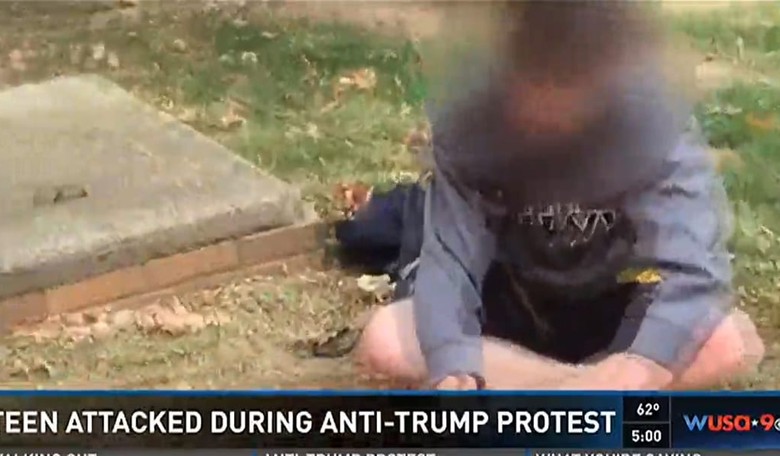 Maryland Teen Beaten At School Sanctioned Anti-Trump Demonstration