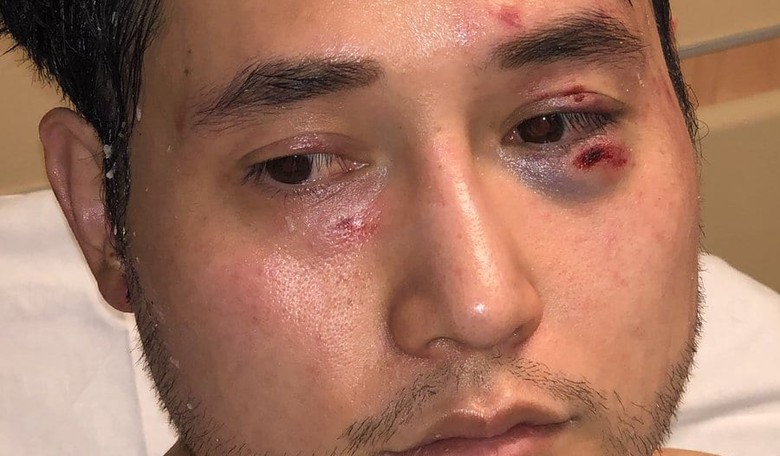 Andy Ngo's Attorney Plans to "Sow Salt" Into Antifa's "Yoga Studios and Avocado Toast Stands"