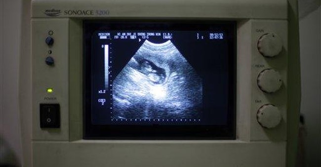 Vice: These Damn Pro-Lifers Keep Using Images of Unborn Babies to Delegitimize Abortion