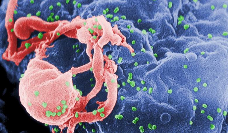 ACLU: Giving People HIV Intentionally Is No Big Deal