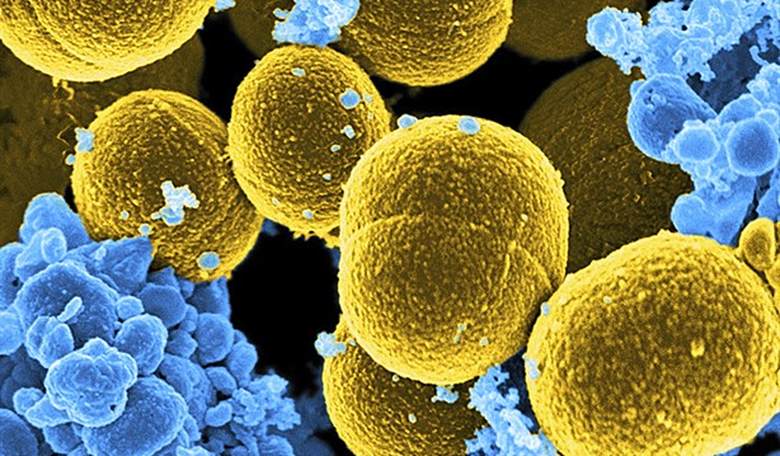 Lessons Lost to History: the Tragically Unheeded 2008 Warning of Biolab Threat