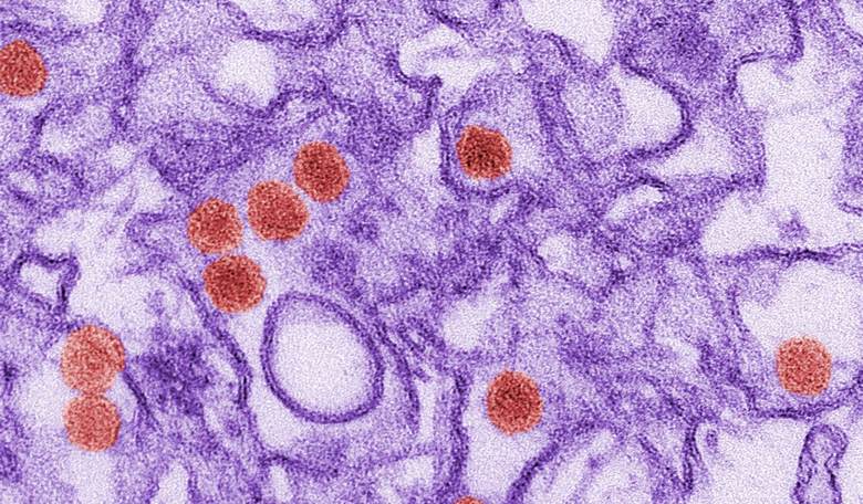 A pandemic-related supply chain shortage of... sperm?