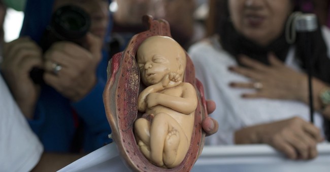 Victory: Trump Administration Ends Federal Scientists' Use of Aborted Fetal Tissue