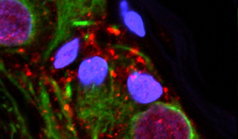 Breakthrough: Researchers Generate New Brain Cells in Adults
