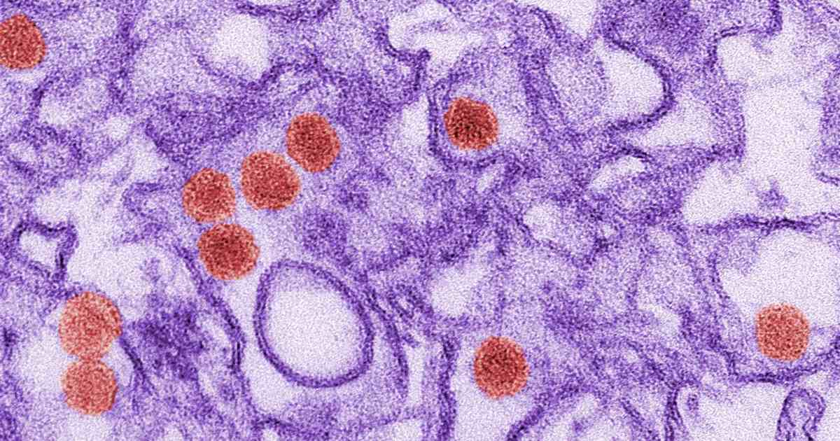 A pandemic-related supply chain shortage of... sperm? - Vimarsana News